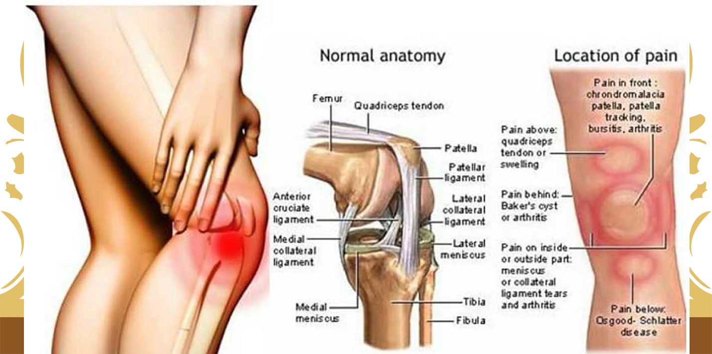 Kenali Penyebab Nyeri Pada Lutut